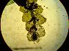 Calypogeia fissa